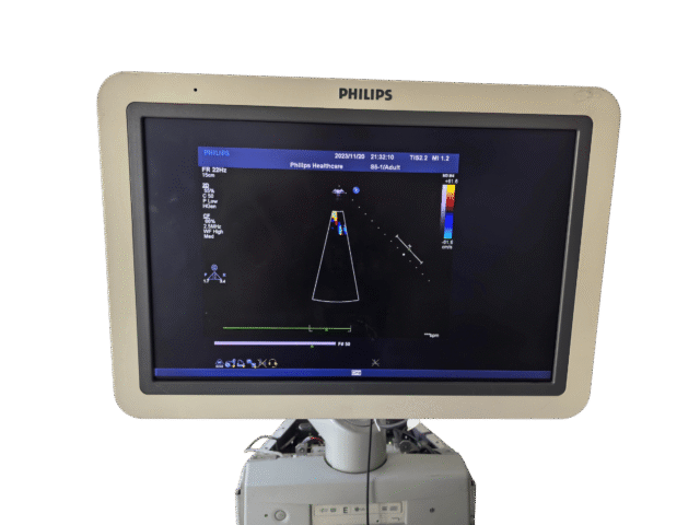 ремонт мониторов Philips HD11